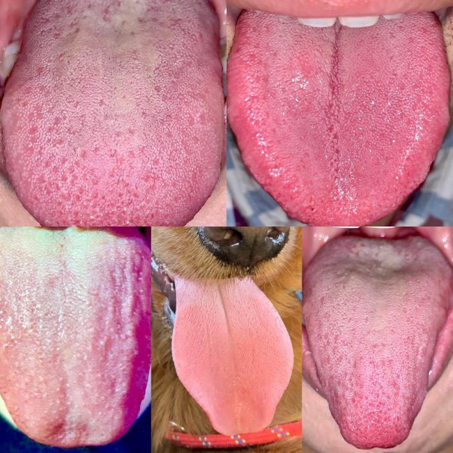 tongue examples