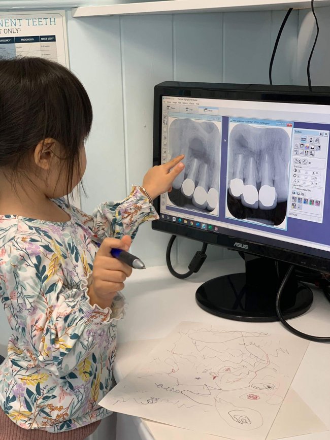 Little girl pointing to a dental x-ray photo on a computer screen